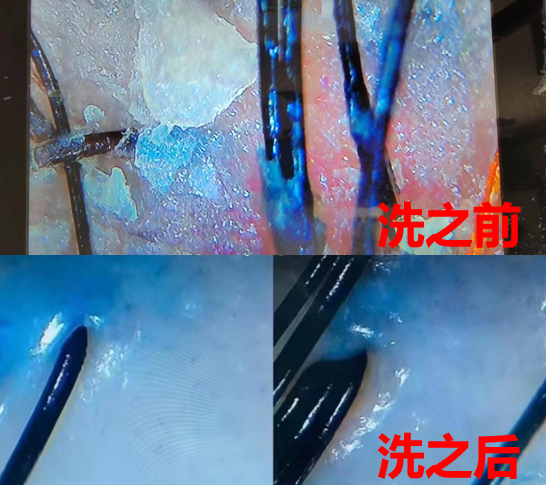 v2-77da8873cd8cf4cc8b18870424fa086d_r.jpg