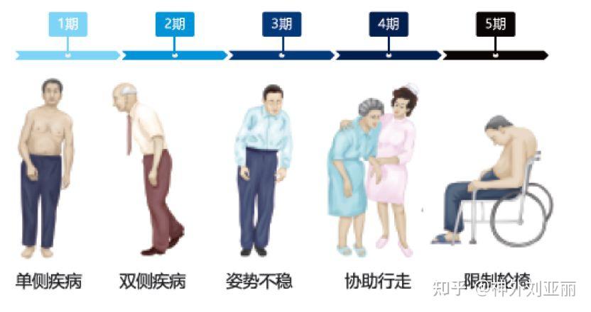 帕金森病程早期、进展期及晚期各阶段的治疗方案怎么选? - 知乎