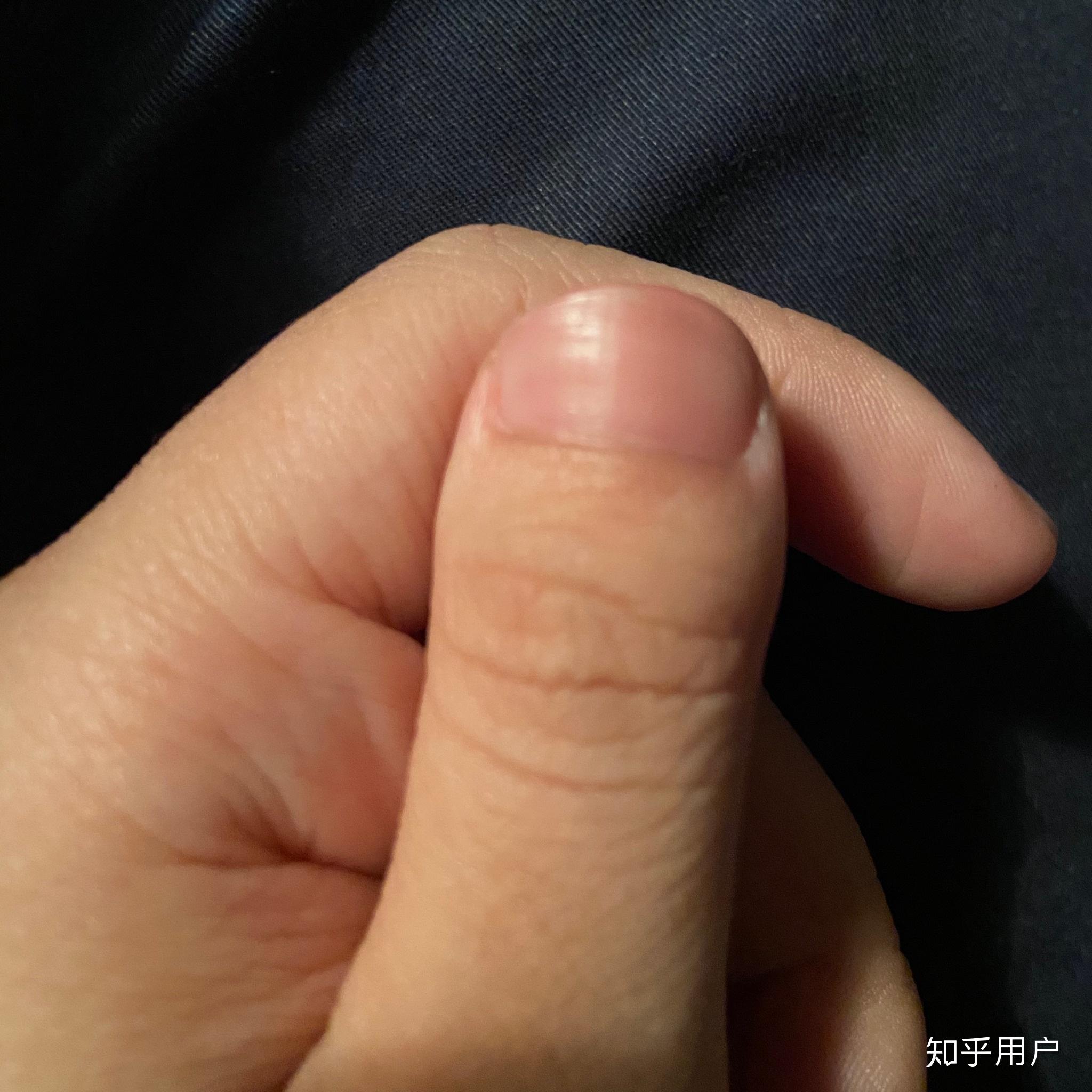 为什么我的大拇指又宽又短? - 知乎