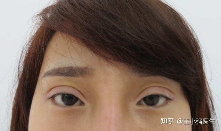 天津市眼科医院 副主任医师王小强医生