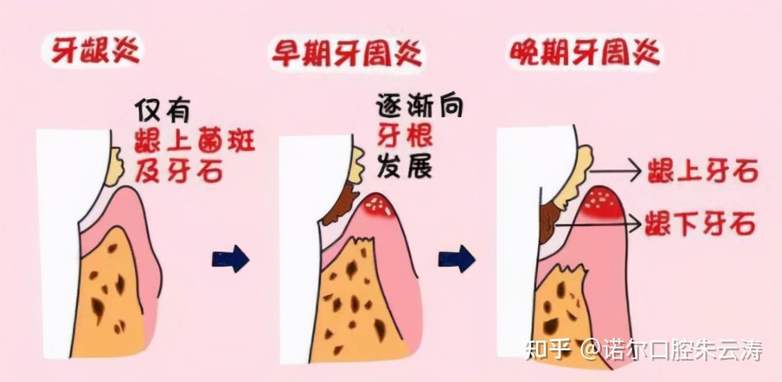 朋友洗個牙花2000發截圖給我我說你花少了