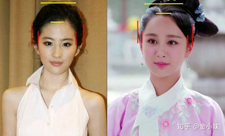 高颅顶是什么意思为什么增高颅顶可以增加颜值