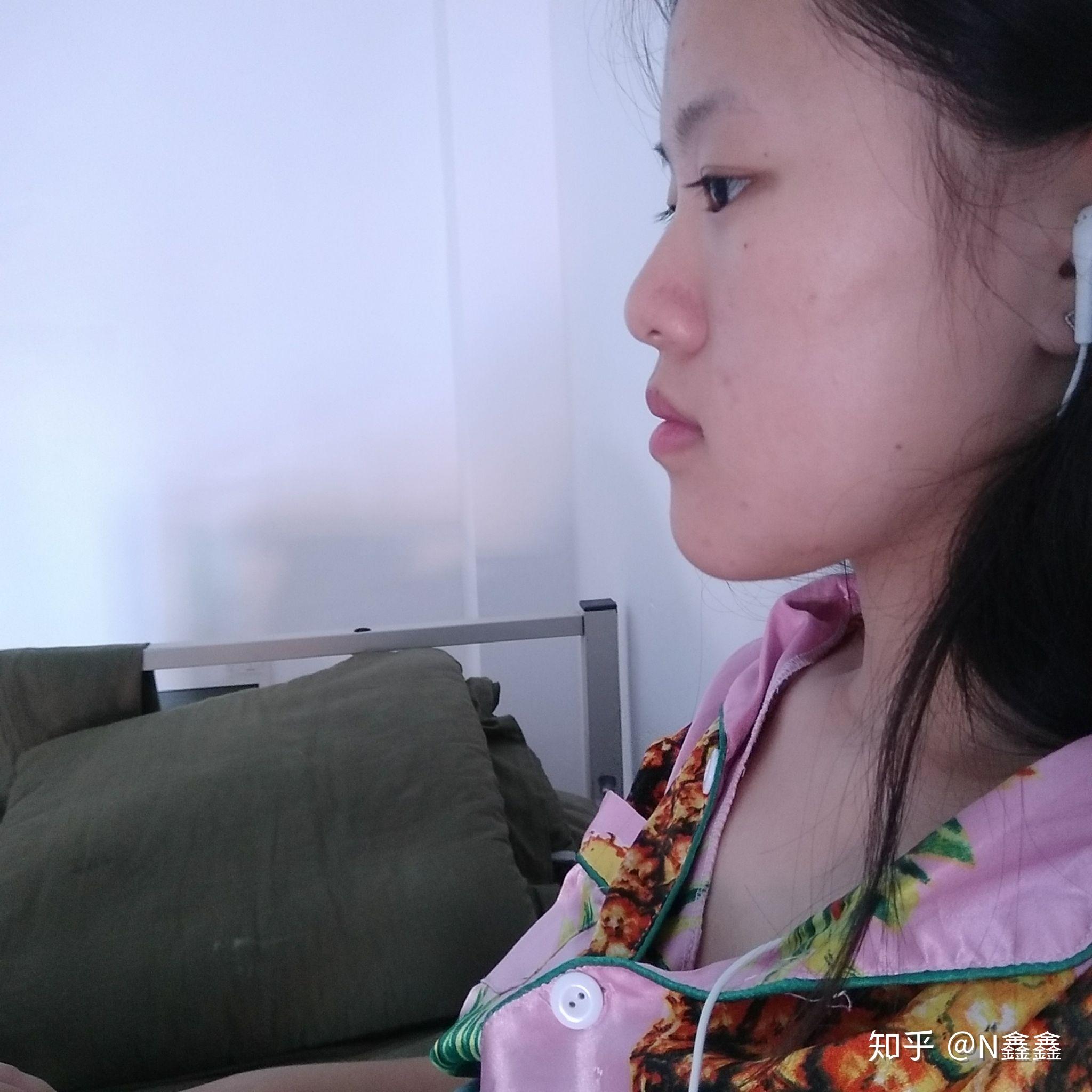 下巴前突但并不是地包天很自卑怎么办