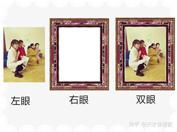 双眼视功能可分为三级:同时视,融合视,立体视.