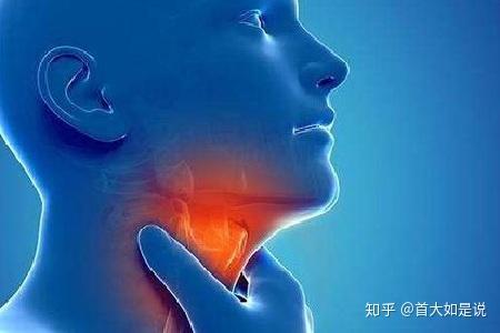 首大计成:激光手术治疗喉癌的适应证与禁忌证 - 知乎