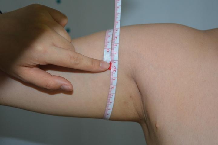 吸脂瘦身是一种什么样的体验