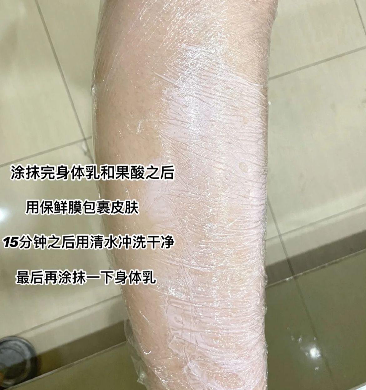 鸡皮肤刷酸正确的护肤步骤要洗吗的简单介绍