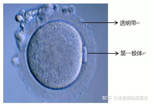 卵细胞肉眼图片图片