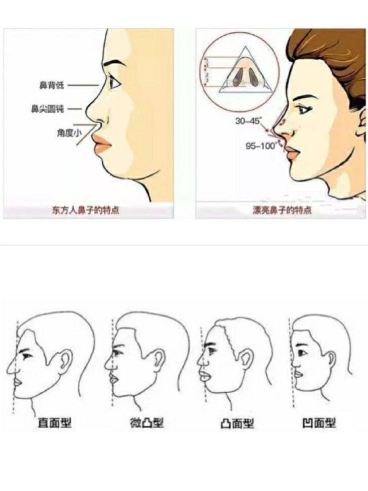 鼻基底凹陷到底该如何改善?