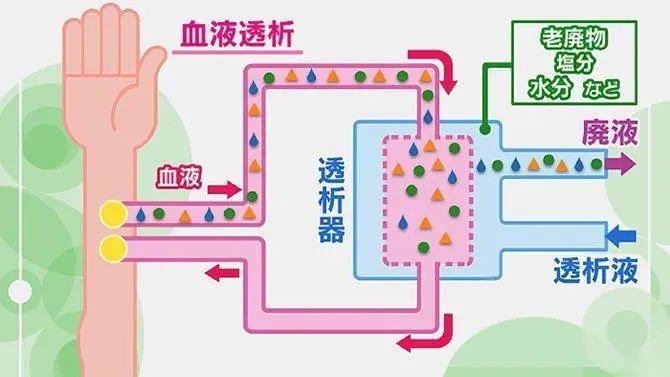 フレネシウス カビ腹膜透析液リーフレット