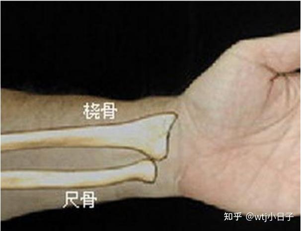 列缺穴位于前臂桡侧缘,桡骨(见图2)茎突上方,腕横纹上1.