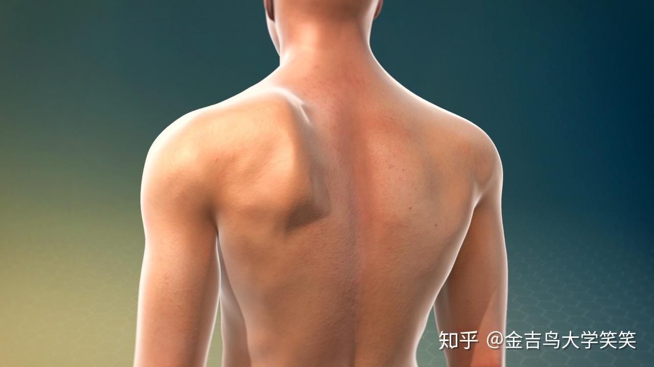 四 胸小肌过度紧张带来的影响