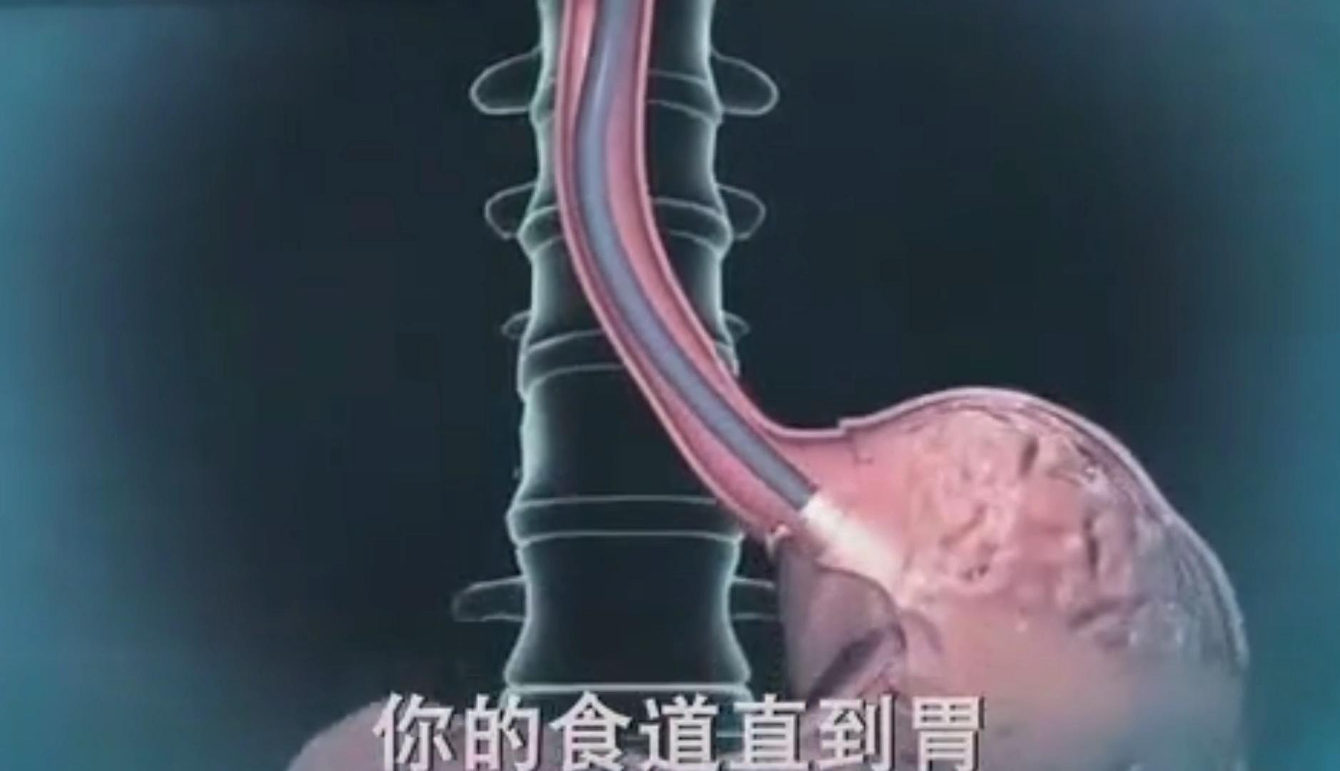 六、吻合器食管空肠端侧吻合术-肿瘤学-医学