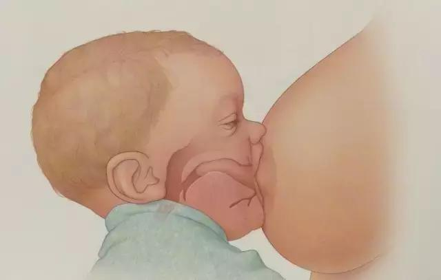 乳头凹陷还能继续母乳喂养吗答案就在这里