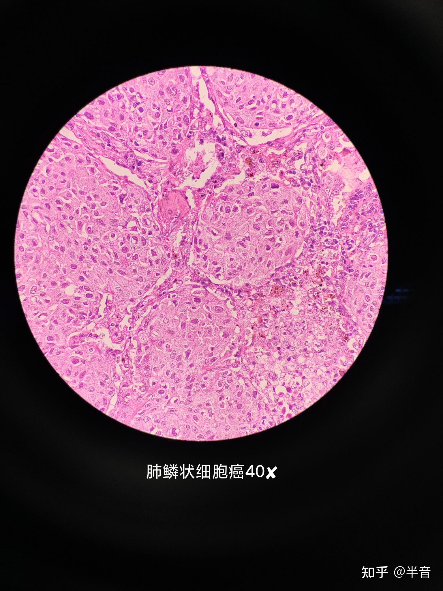 病理实验课观察切片