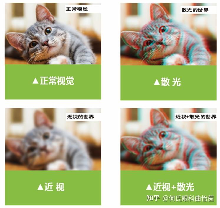 近视和散光傻傻分不清? - 知乎