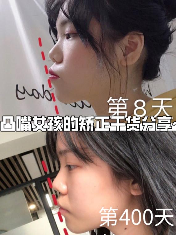 v2-7a3a9265ce810e724e3ab1a21da0421c_1440w.jpg?source=172ae18b