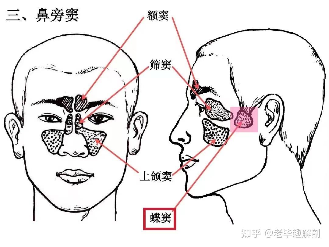 蝶窦图解图片