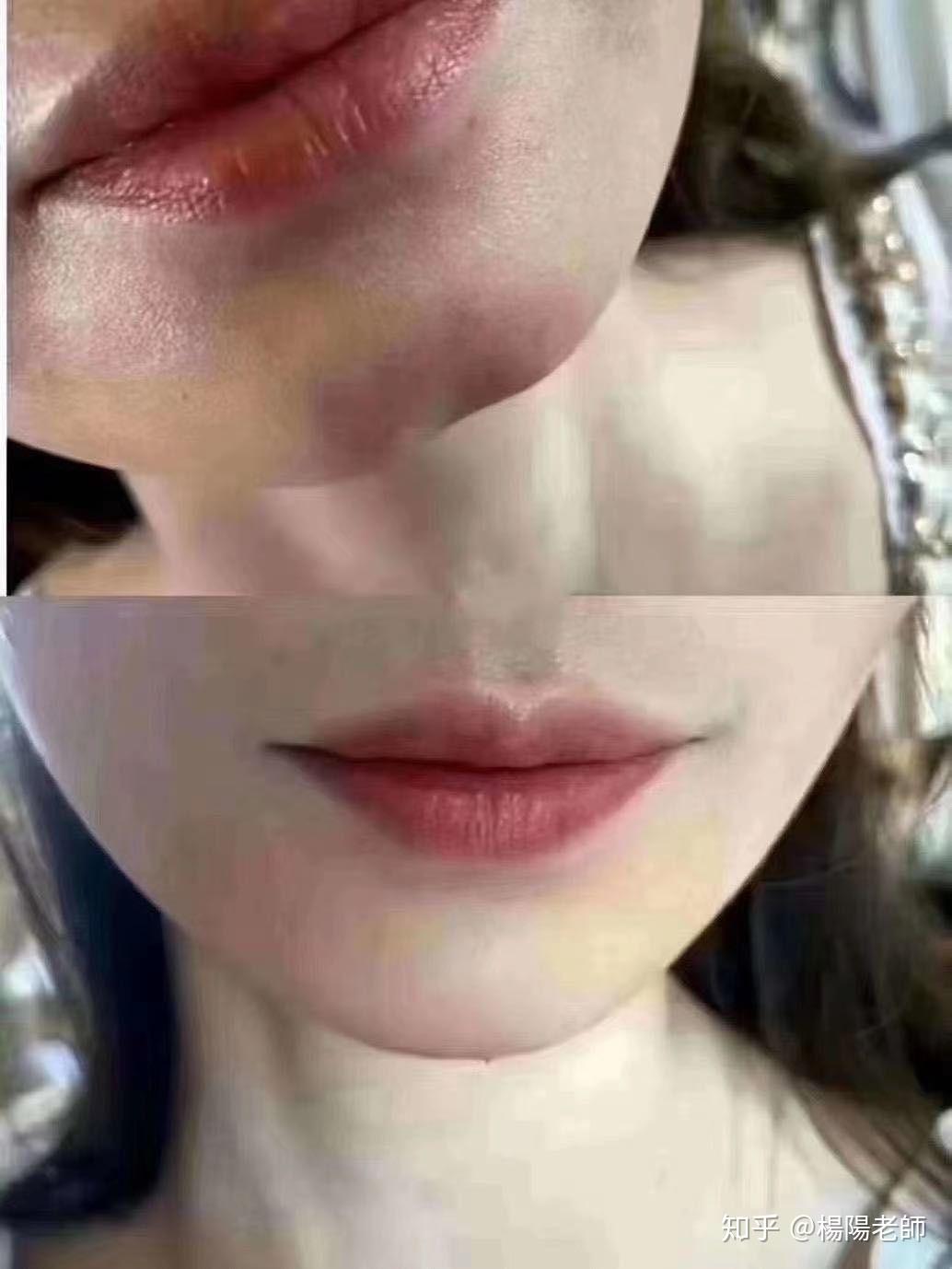 下巴有坑的人十有八九都漏财