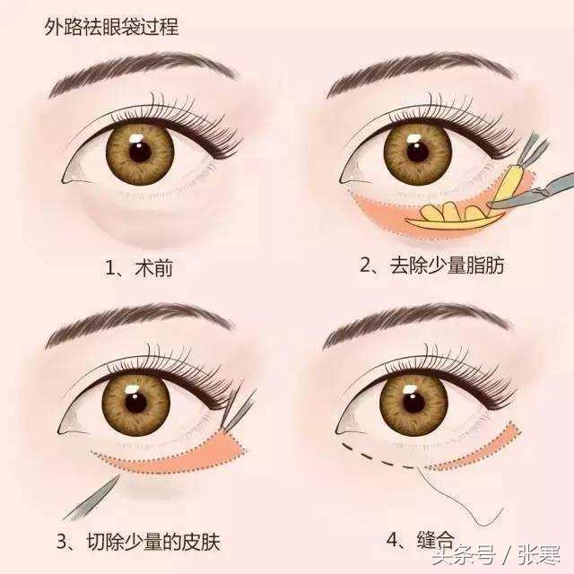 v2-7a7ec29e75bad39c52af8c3b89156bad_r.jpg