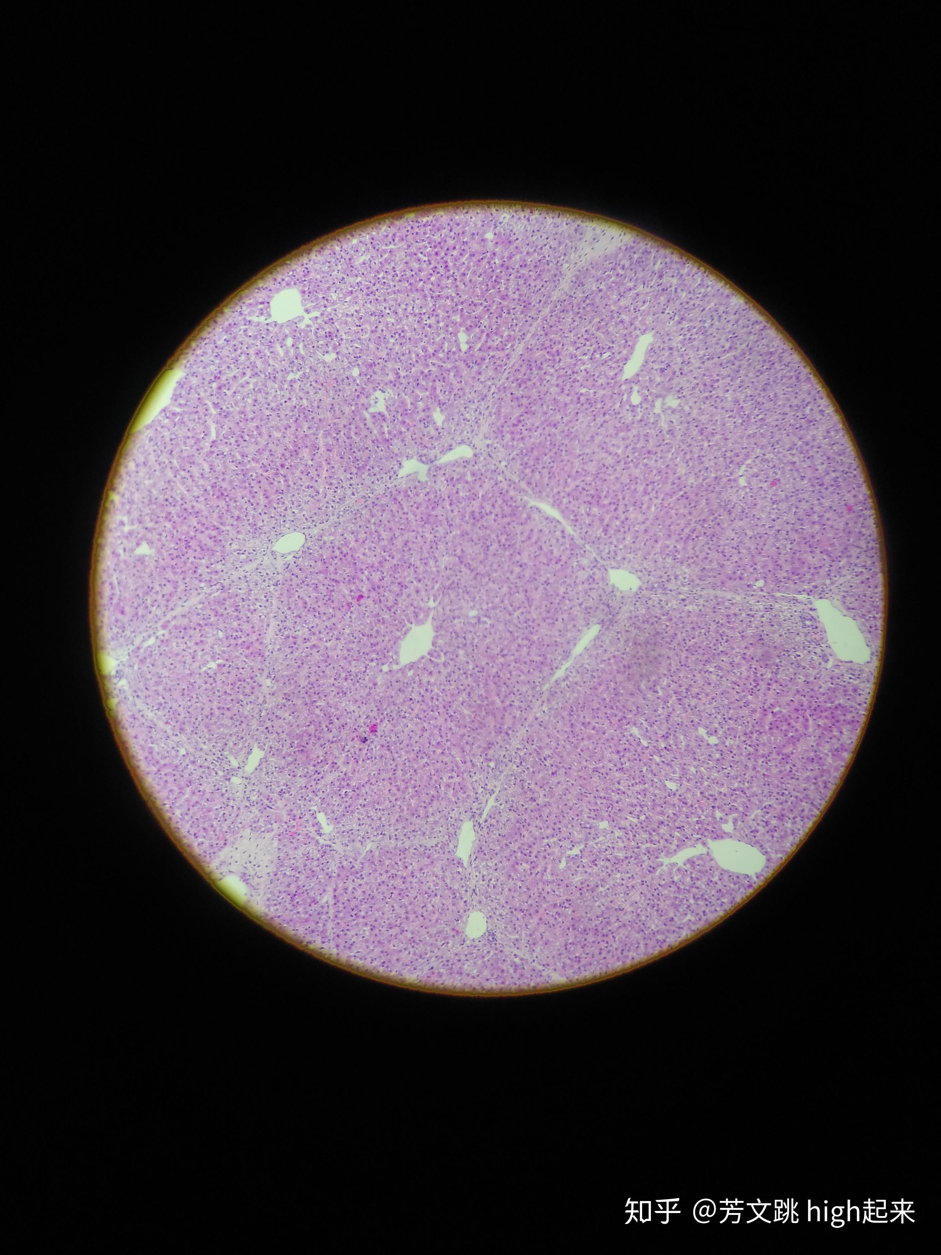 肝小叶的显微镜结构图图片