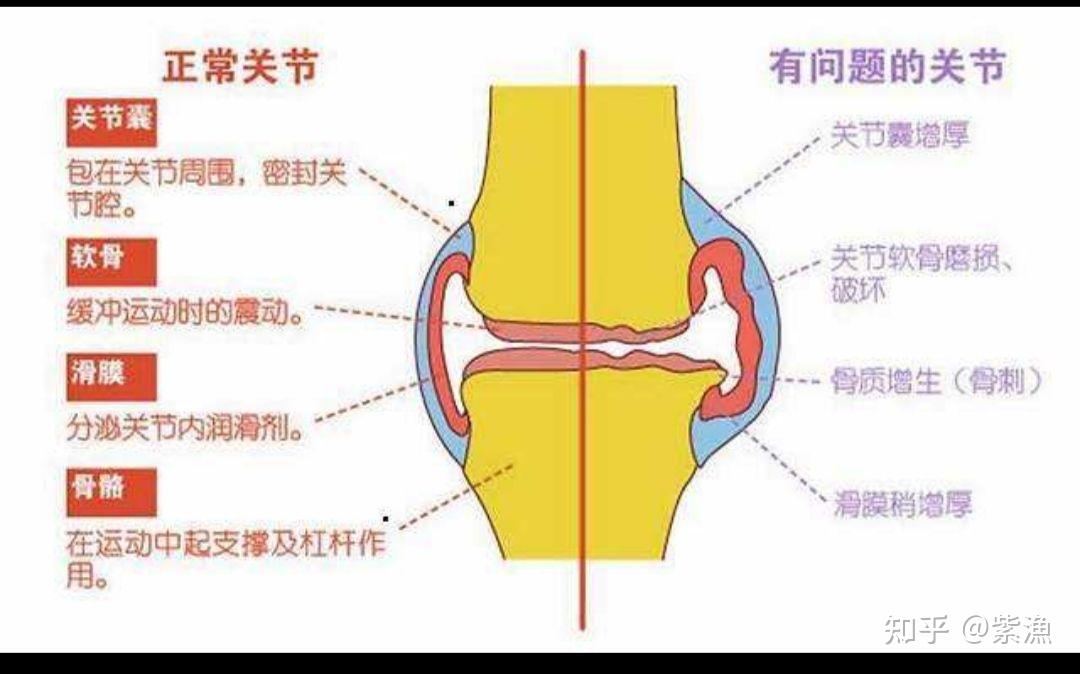 关节结构模式图及作用图片