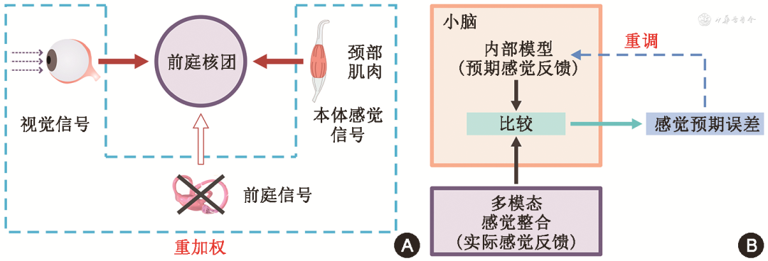 文献综述|前庭代偿机制与前庭康复治疗 - 知乎