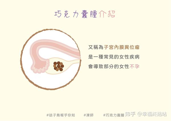 认识子宫内膜异位症—巧克力囊肿 知乎