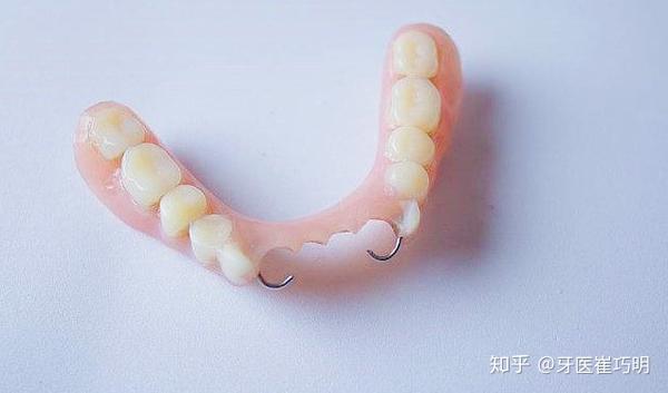 种牙镶牙假牙套你居然不知道咋选