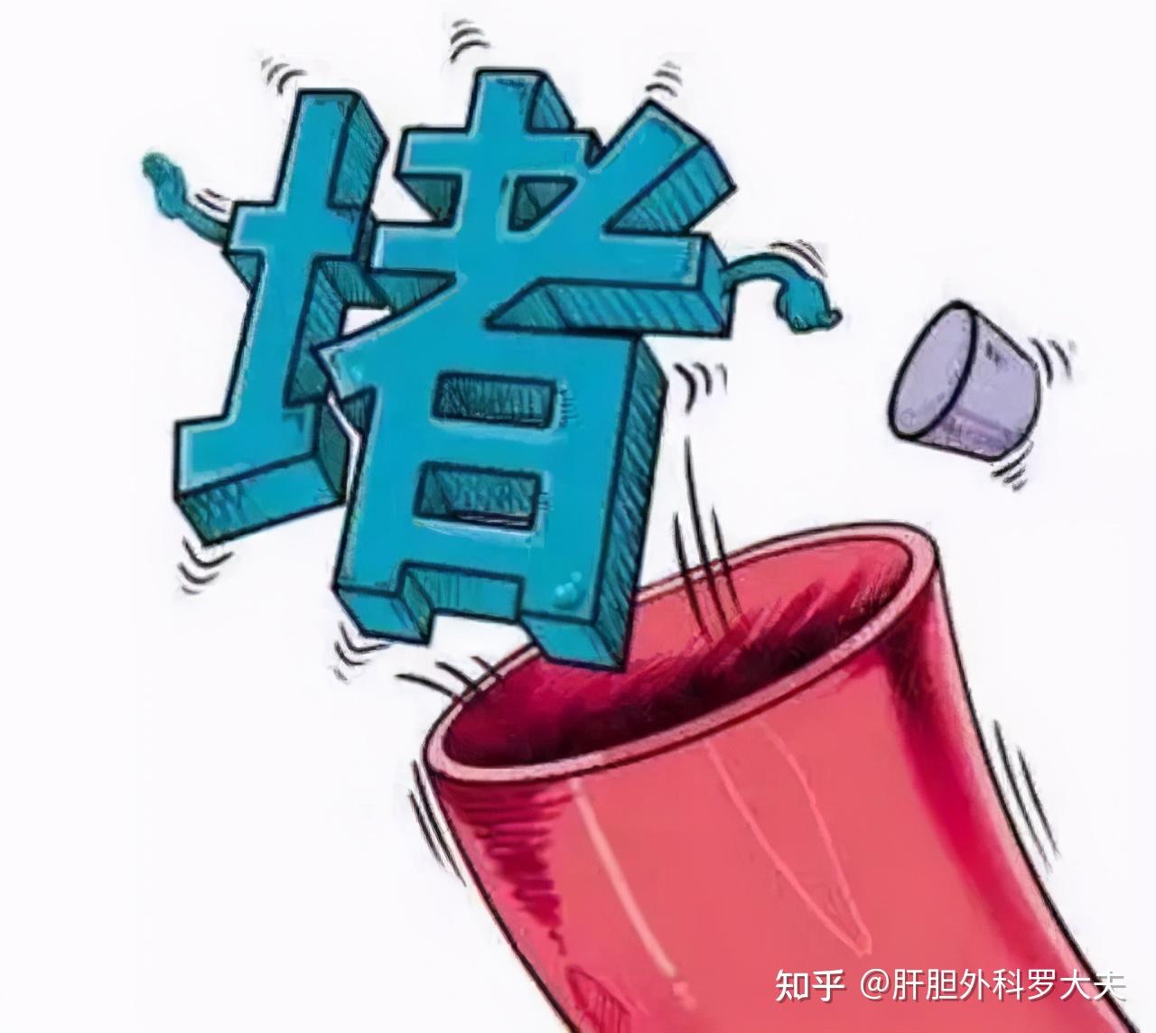 v2-7b63a60d9796e46b172dc4425e68db19_r.jpg