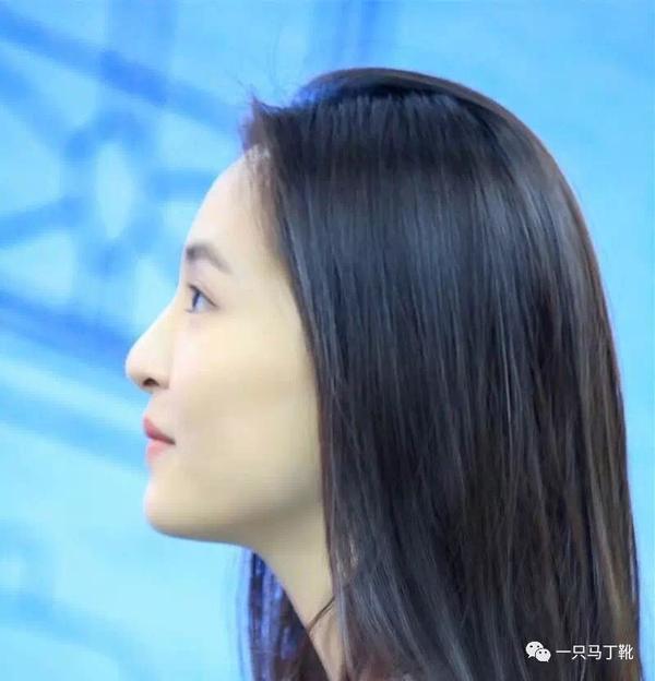 可能与上颌骨过于突出,或上唇的提肌力过强,或上唇偏短,或深覆合等