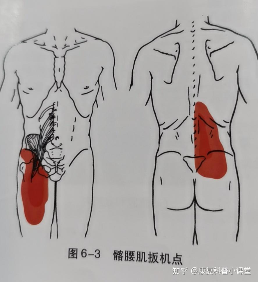 腰大肌肌间沟解剖图图片