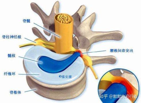 健康知識分享腰椎間盤突出症是什麼