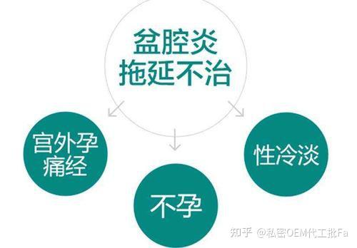 盆腔炎附件炎特征及治疗方法 - 知乎