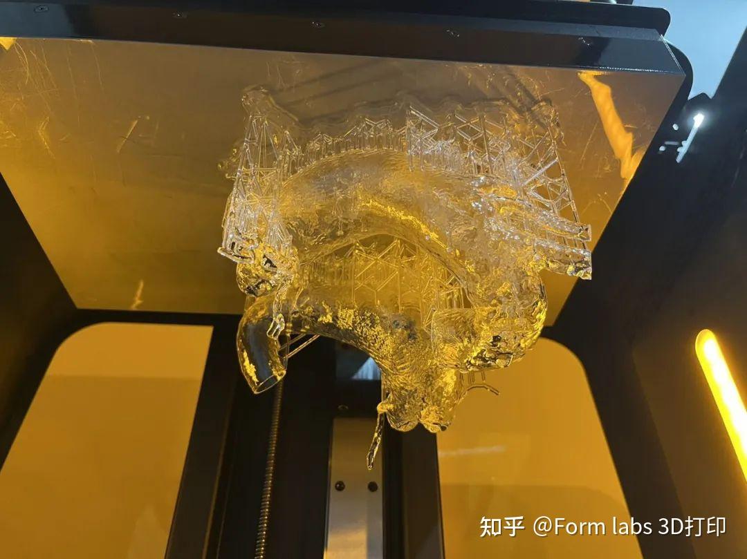 3D打印手术导板在三甲医院应用实例:高效、精确匹配不同手术类型 - 知乎
