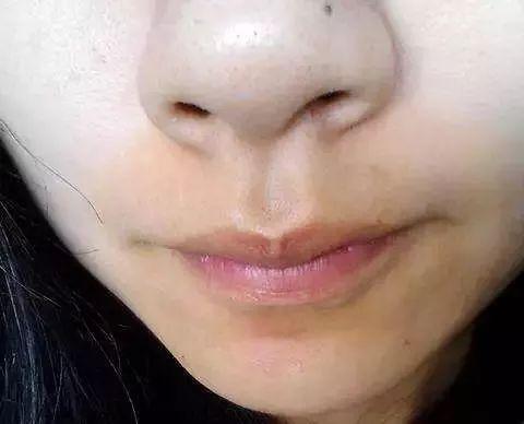 直击唇周暗沉 10个姑娘中有9个都有 该怎么解决 知乎