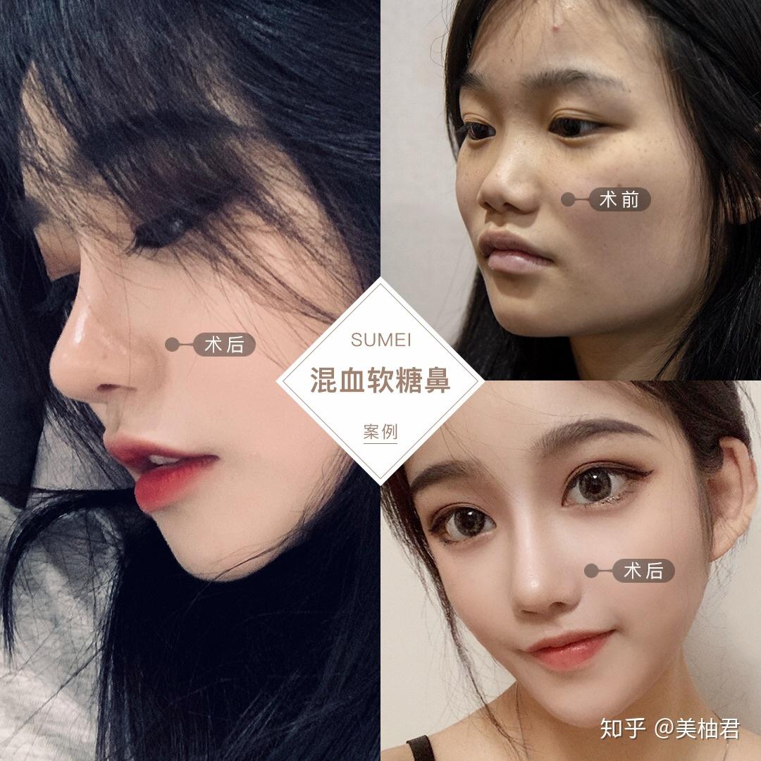 甜美的混血系鼻子想要嘛,混血软糖鼻get√ - 知乎