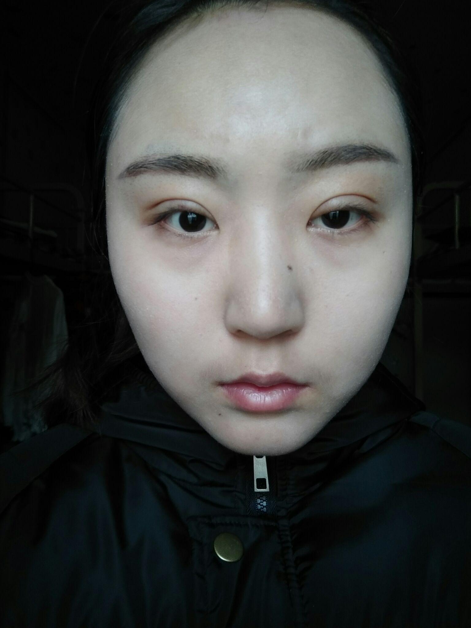 全切双眼皮宽窄不一样呀? - 知乎