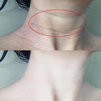 颈纹是女人的年轮!你的脖子几岁了? - 知乎