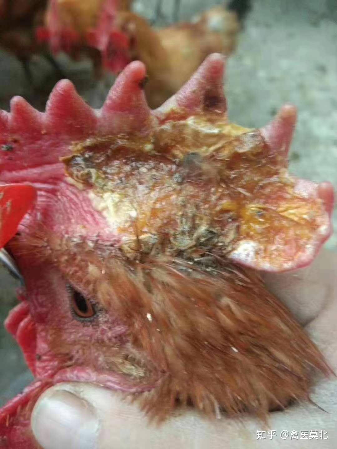 鸡冠癣怎么治