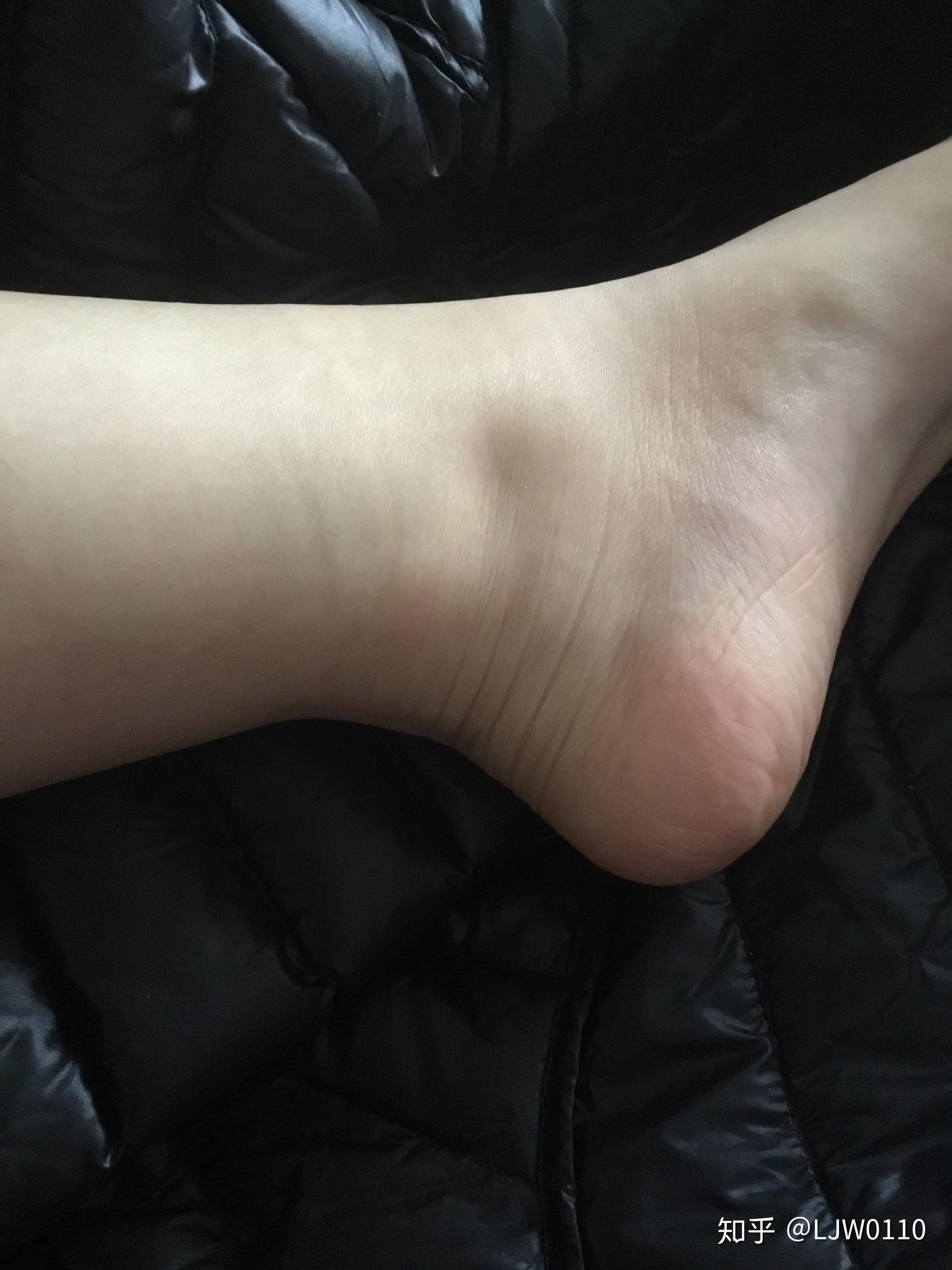 没有脚踝是怎么样一种体验