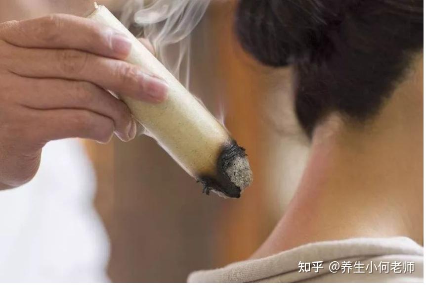 感冒咳嗽有痰如何艾灸