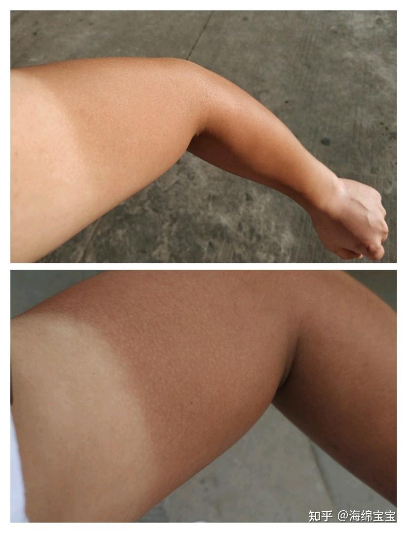 我肚子肤色格外暗肤色虽不能说白了,但皮肤在亮度上不那么暗沉了到这