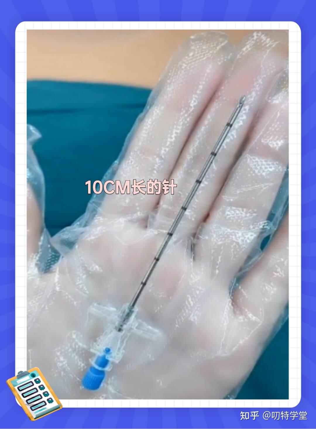 真的破防了,这是你媳妇生孩子打的针 - 知乎