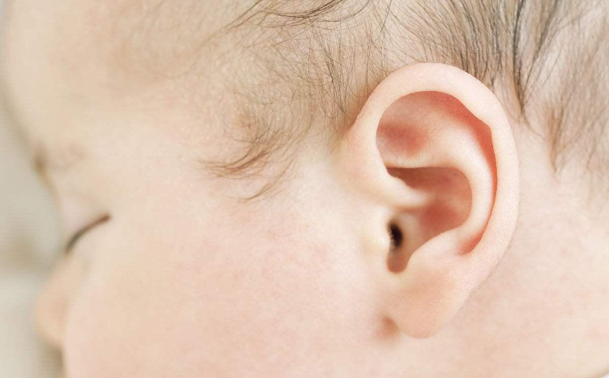 发现新生儿耳畸形后怎么处理 十个问题完美解答新生儿耳廓畸形 知乎