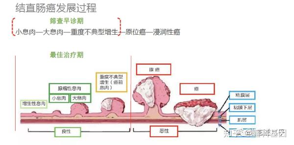 国内创新型肠癌早筛公司- 知乎