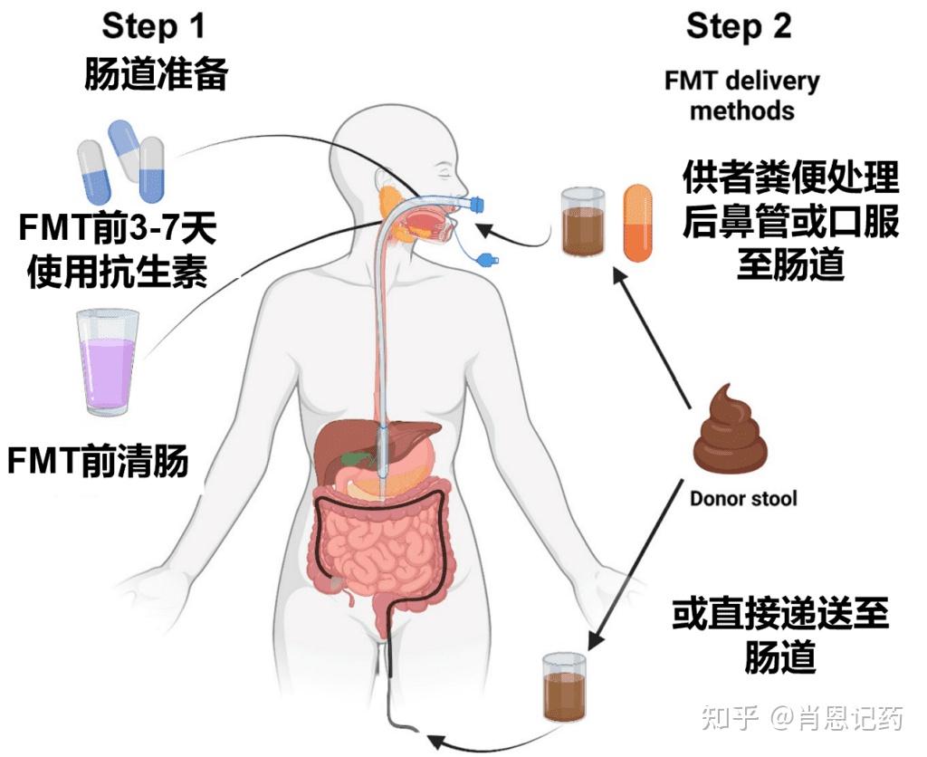 如何记住所有FDA批准生物药？| 中和艰难梭菌毒素B | Bezlotoxumab 贝洛托单抗 | 治疗艰难梭菌感染 - 知乎
