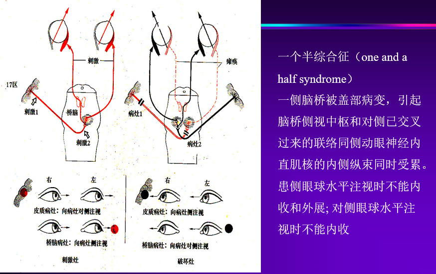 同向性偏盲图片