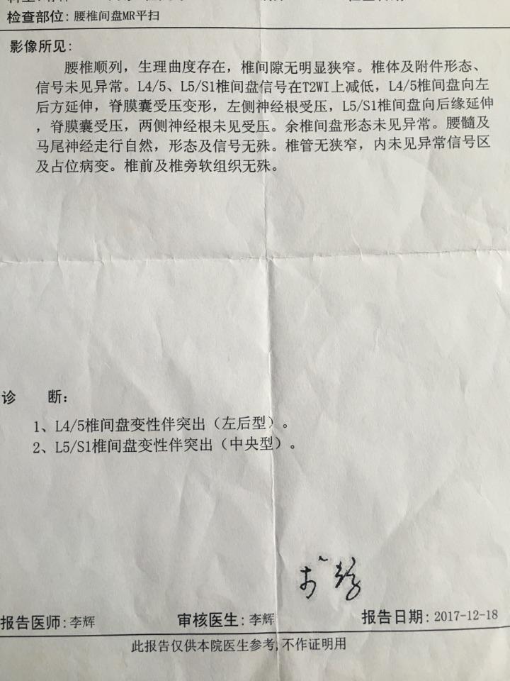 腰间盘l45l5s1突出怎么治疗