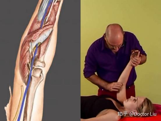 mediannerve正中神经松动